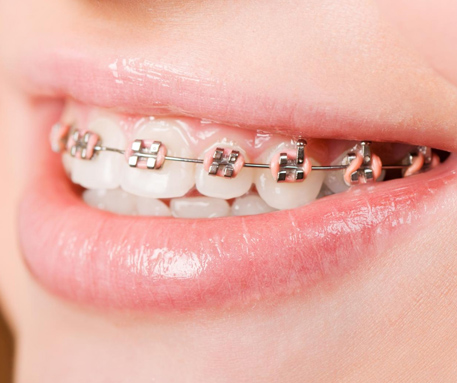 Clínica Dental Delgado ortodoncia